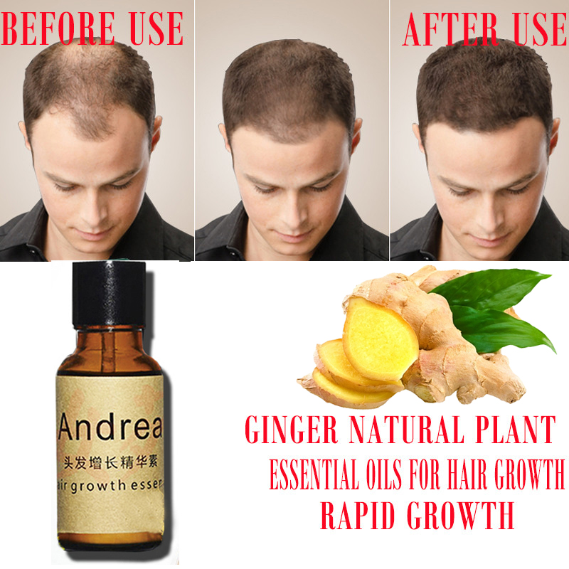 2/5/10 個アンドレア育毛血清オイルハーブケラチン高速育 - Biotin Hair Growth のレビューと価格