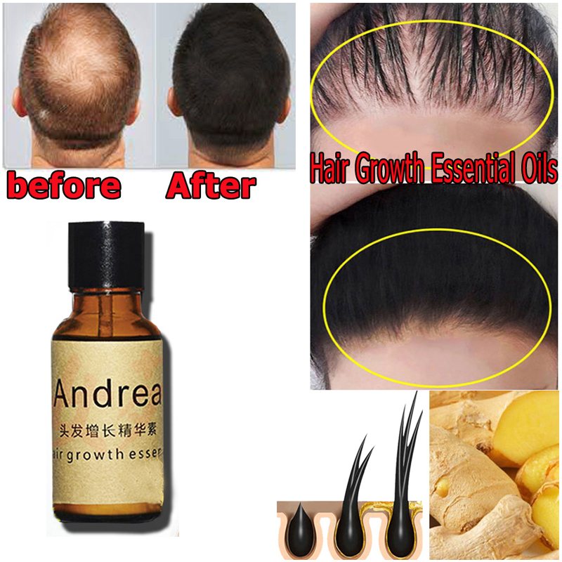 2/5/10 個アンドレア育毛血清オイルハーブケラチン高速育 - Biotin Hair Growth のレビューと価格